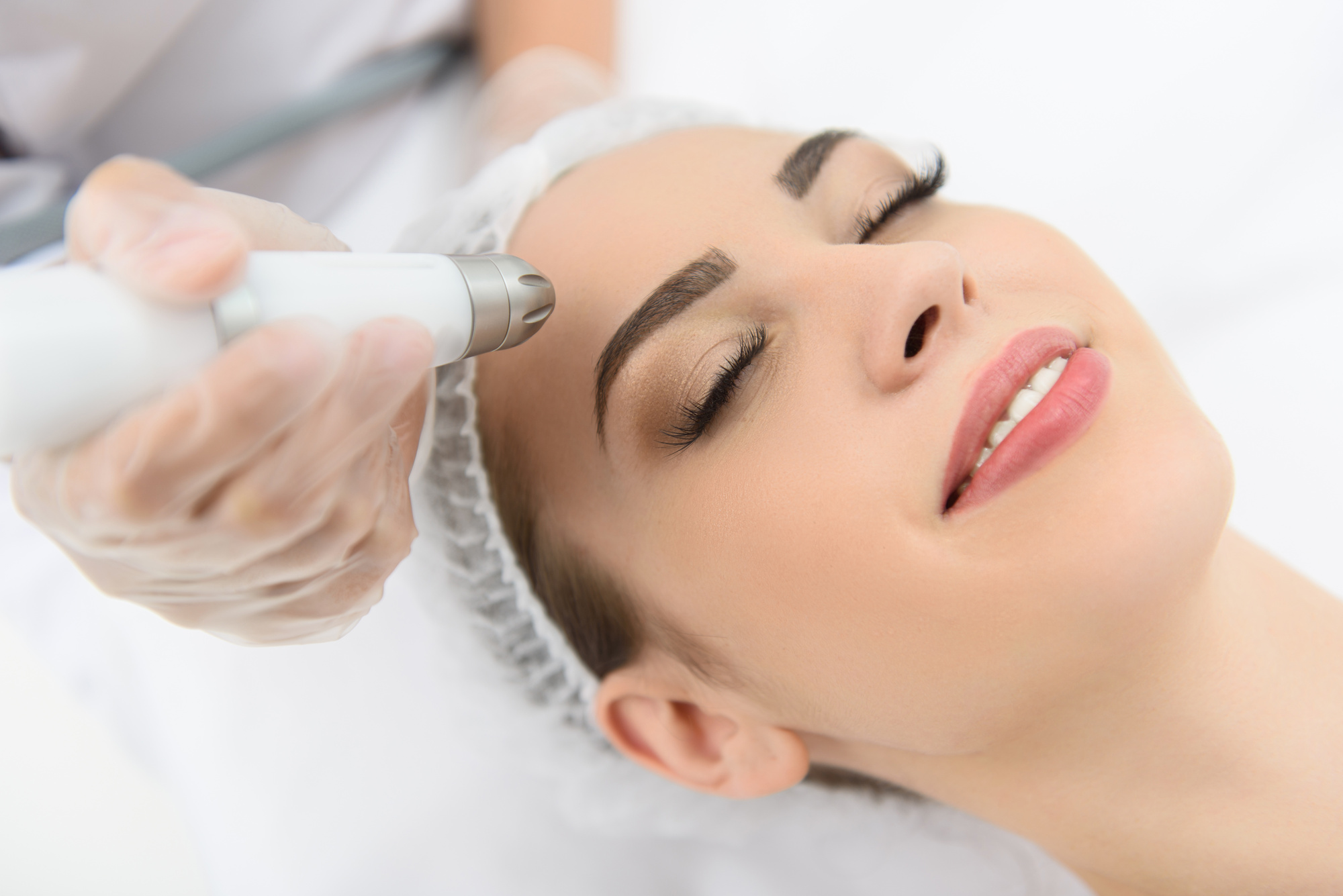 Laser Treatment To Remove Excess Facial Hair